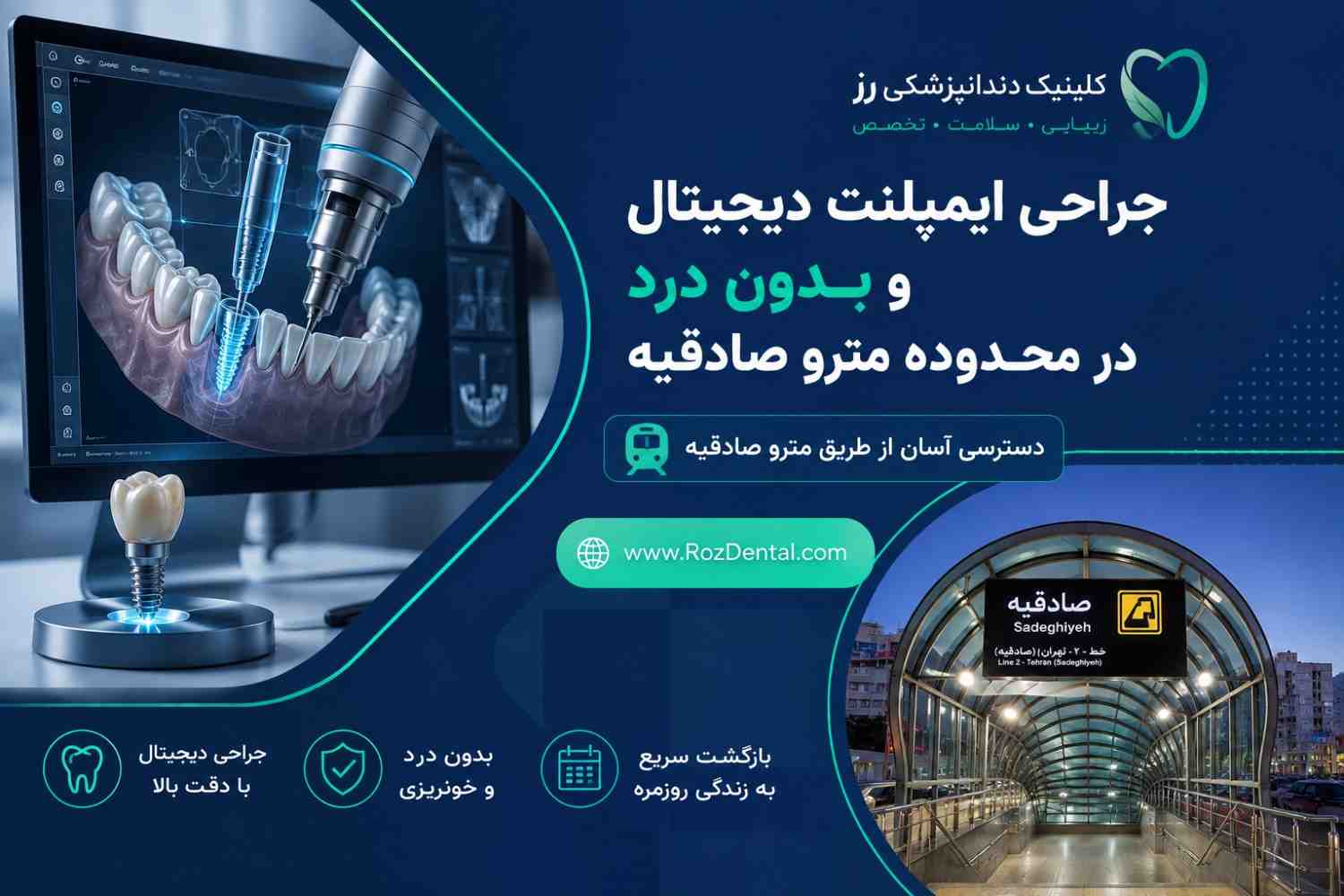 جراحی ایمپلنت دیجیتال و بدون درد در محدوده مترو صادقیه