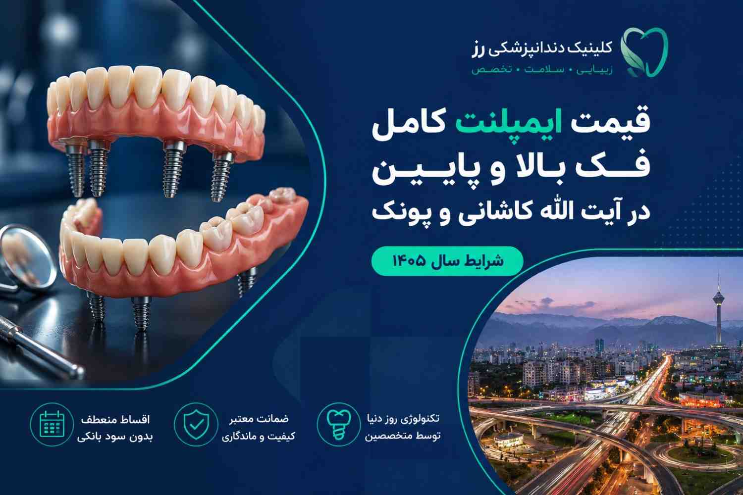 قیمت ایمپلنت کامل فک بالا و پایین در آیت الله کاشانی و پونک