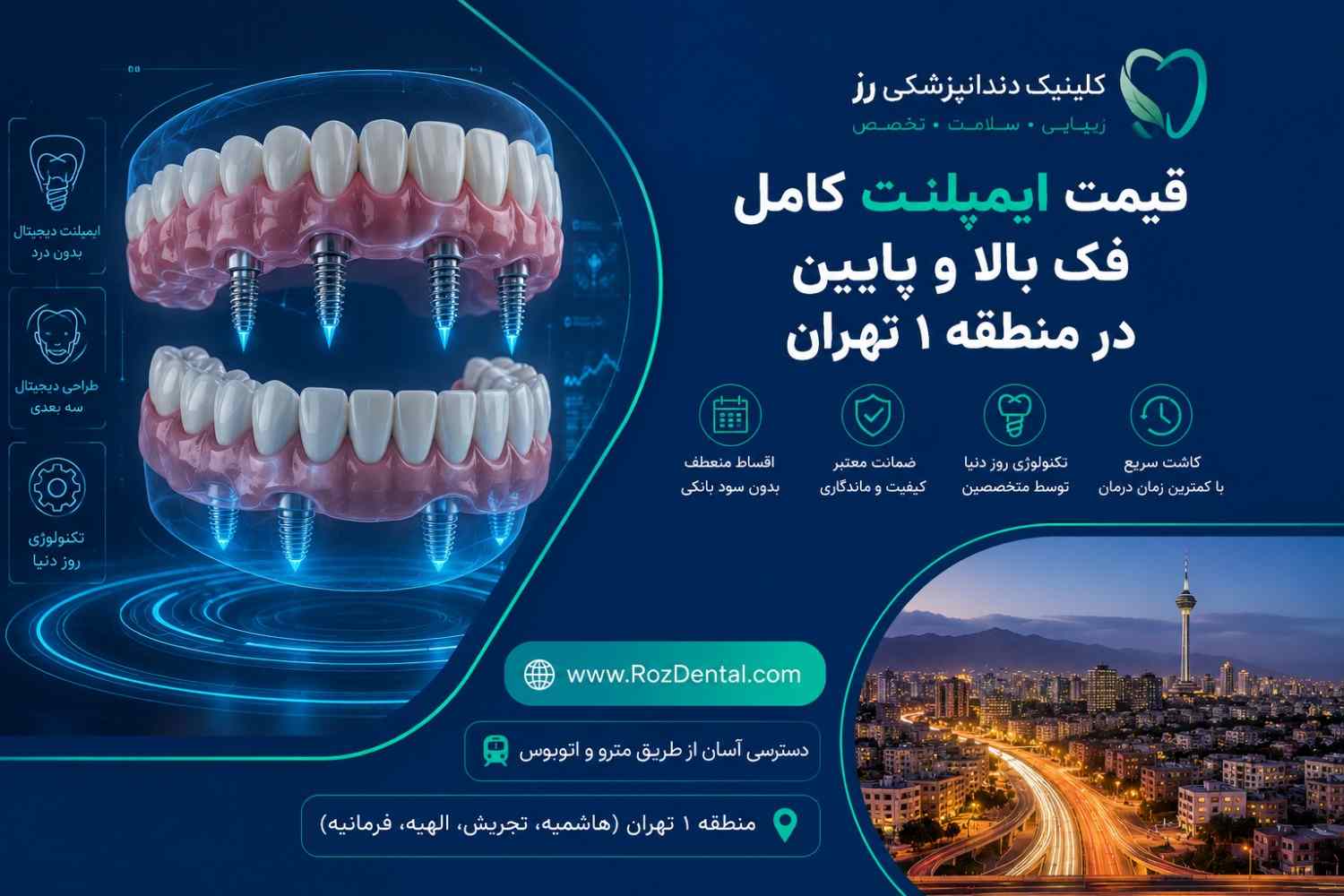 قیمت ایمپلنت کامل فک بالا و پایین در منطقه ۱ تهران