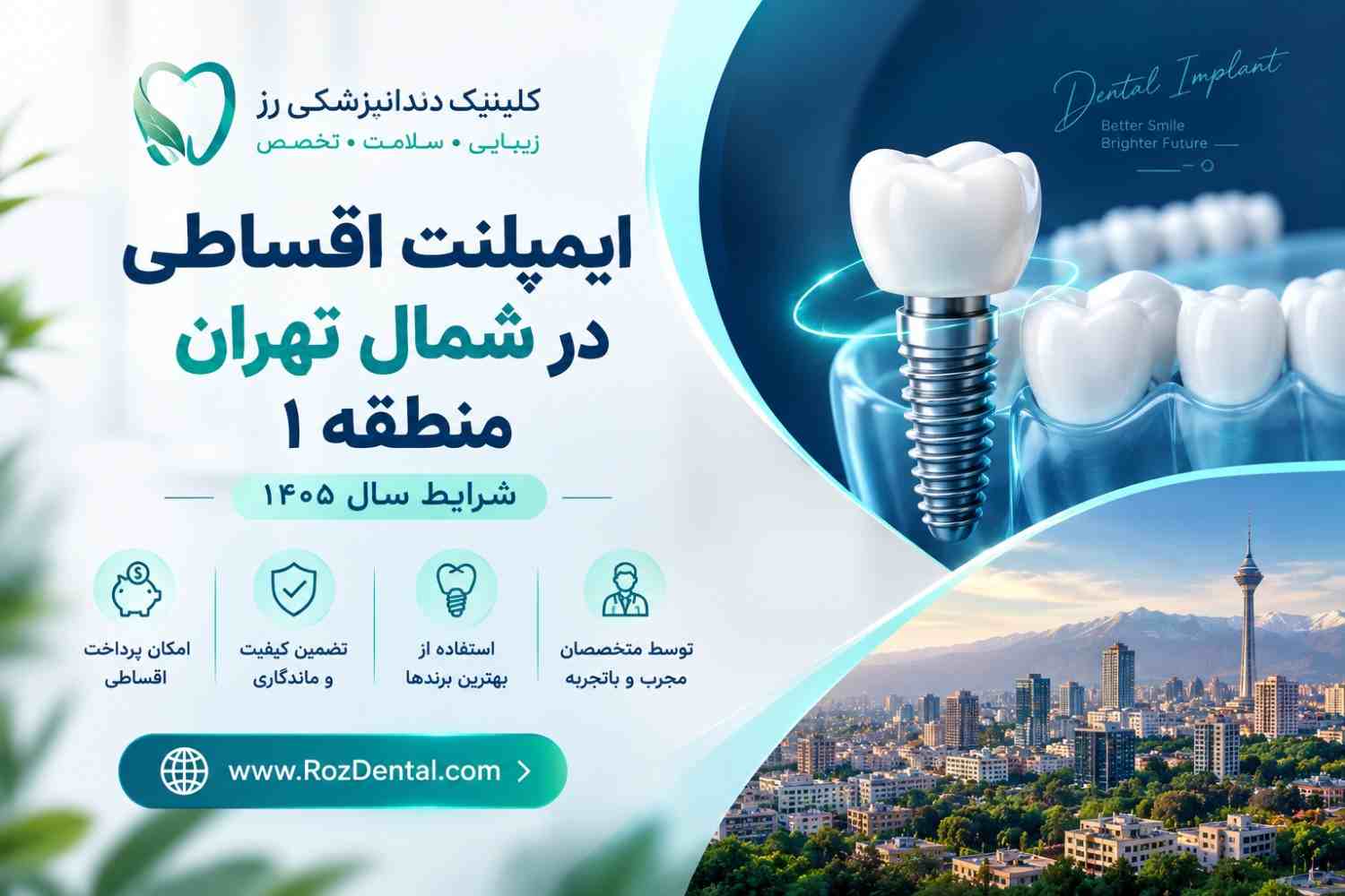 ایمپلنت اقساطی در شمال تهران منطقه ۱